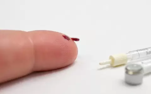 Prueba de sifilis.