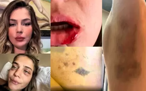 Jannah Nebbeling y las capturas de foto que acompa�aron su denuncia p�blica.