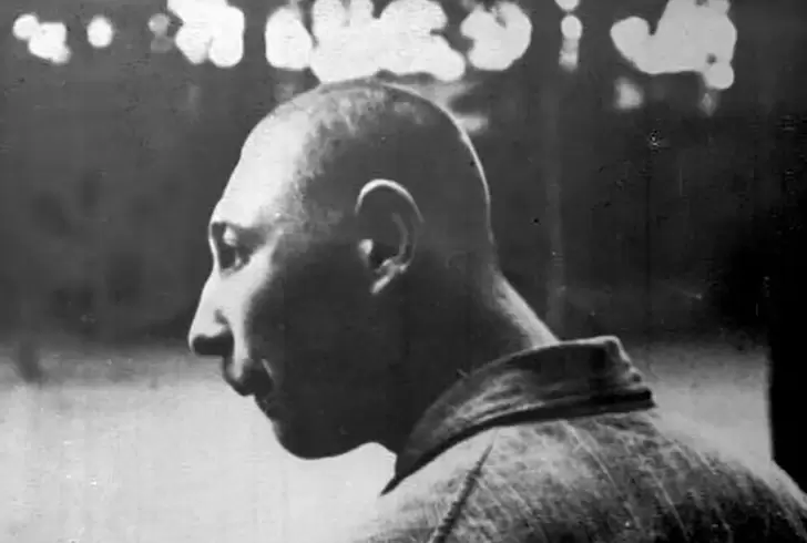 Esta fotografía se usó para la propaganda nazi con la siguiente leyenda este enfermo mental cuesta 2 mil marcos por año al Estado. Foto: Infobae.