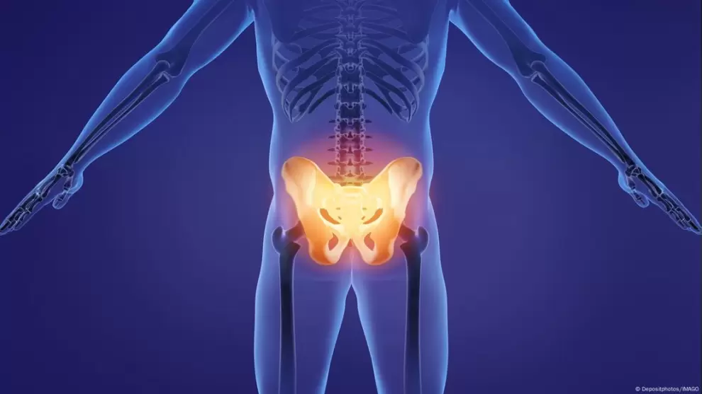 Mutaciones en los genes SOX9 y PTH1R causan enfermedades esquel�ticas en la pelvis.
Imagen: Depositphotos/IMAGO/DW