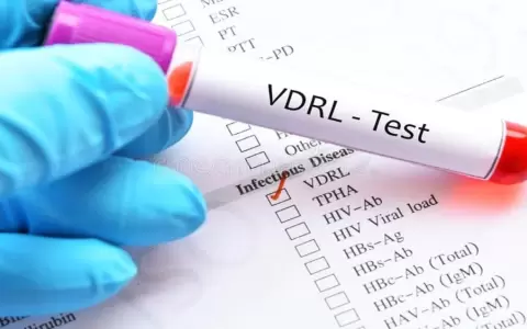 Test de VDRL para detectar la presencia de s�filis.