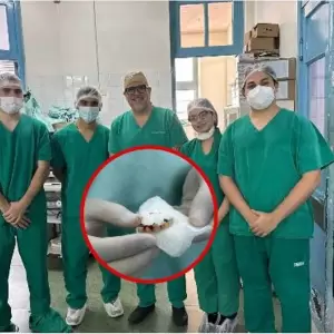 Extraen cinco dientes del pulm�n de un paciente en el Ineram