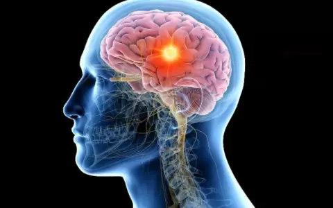 Par�lisis Cerebral.