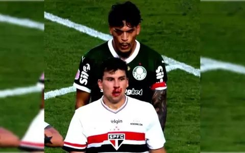Gustavo G�mez tuvo otro encontronazo en el Brasileir�o