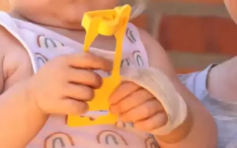 La madre denunci� que la cirug�a se realiz� en la mano sana de su hija, de apenas un a�o.
