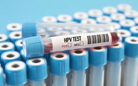 Prueba del VPH - Virus del Papiloma Humano.