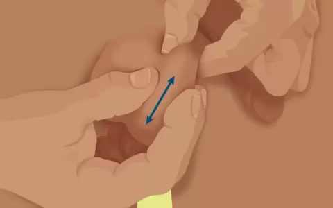 Autoexploraci�n testicular.