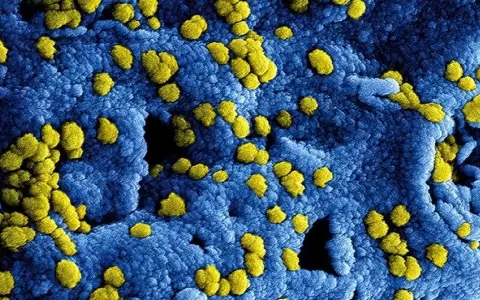 Coronavirus MERS.