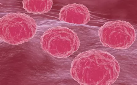 Clamidia: Es una infecci�n bacteriana que puede afectar a los genitales, al recto y/o a la garganta tanto de hombres como de mujeres.