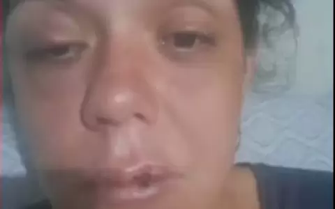 Gessica Ben�tez, v�ctima de agresi�n por su expareja.