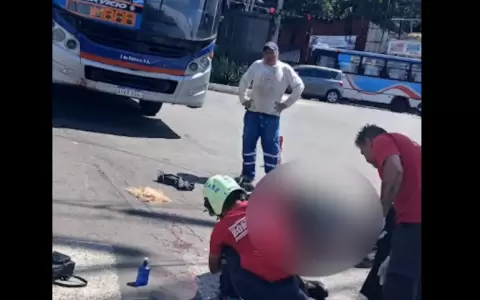 Joven pasajera de Motobolt pierde el cuero cabelludo tras choque con colectivo en Lambar�