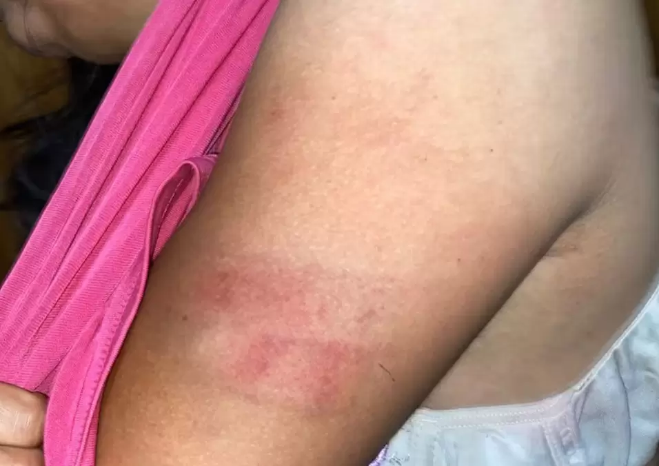 Hombre agredi� a su pareja con varilla de hierro.