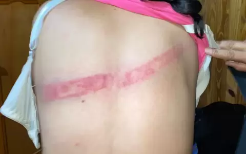 Hombre agredi� a su pareja con varilla de hierro.