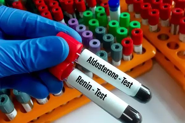 Sobrecarga de testosterona: un factor poco apreciado que contribuye a la hipertensión arterial. Foto: The New York Times.
