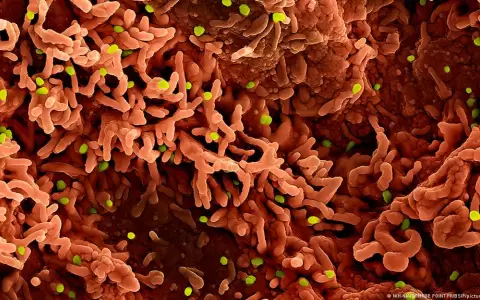 Part�culas del virus mpox (en verde) sobre c�lulas infectadas, observadas mediante microscop�a electr�nica de barrido con colorizaci�n artificial.