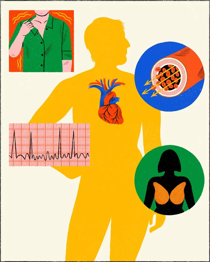 Efectos del alcohol en el cuerpo. Foto: Montse Galbany / The New York Times.