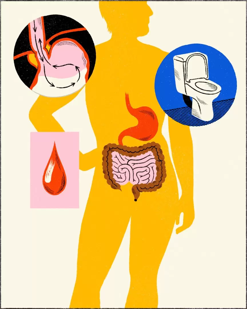 Efectos del alcohol en el cuerpo. Foto: Montse Galbany / The New York Times.