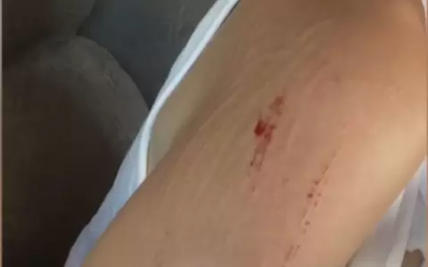 La mujer denunci� haber sido agredida f�sicamente por su primo, un suboficial de Polic�a,por un conflicto relacionado con la delimitaci�n de propiedad