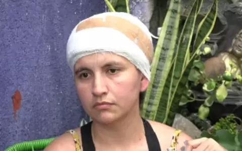Johanna Ortiz apela a la solidaridad ciudadana para poder cubrir los elevados costos de su tratamiento m�dico.