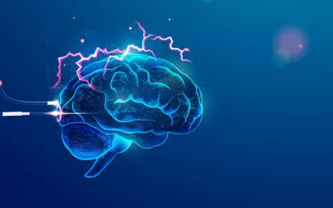 Cerebro.