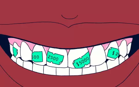 Una caries no siempre necesita empaste