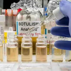 Salud Pública investiga casos de botulismo alimentario en el país