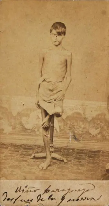 Ni�o paraguayo despu�s de la guerra. Fot�grafo no identificado, ca. 1868. Museo Hist�rico Nacional, Buenos Aires.