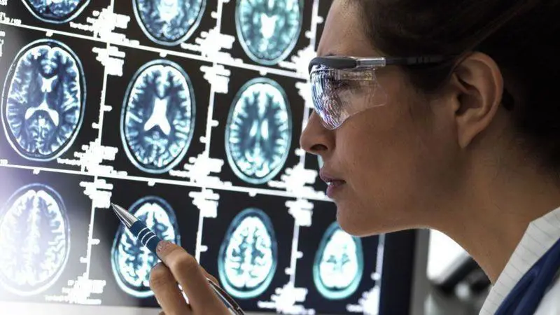 La enfermedad de Alzheimer se caracteriza por la p�rdida de c�lulas cerebrales o neuronas. Foto: BBC.