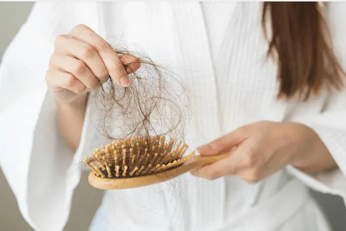 Ca�da de cabello. Foto: Infobae.